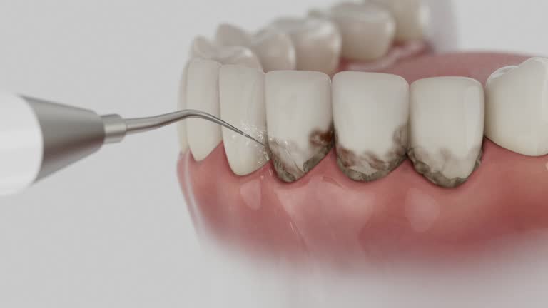 Reliable Teeth Cleaning And Checkup contractor in Buffalo, MO by Smile Center Dentistry